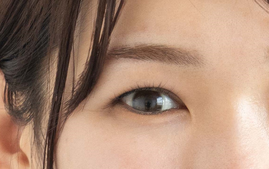 奈良県橿原市の二重整形「小切開」はスッキリとした二重まぶたへ導く