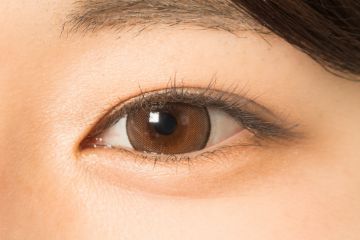 奈良県橿原市の二重整形「全切開法」奥二重