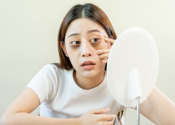奈良県橿原市の目の下のたるみ・クマ治療