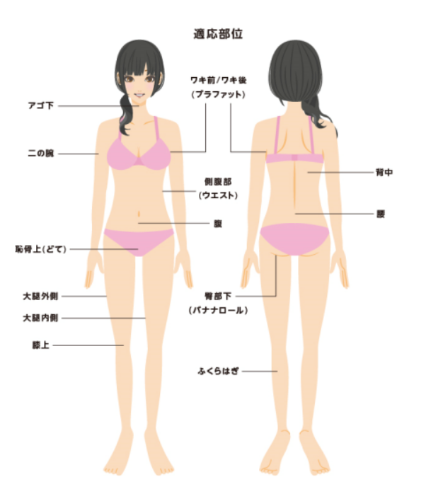 奈良県橿原市の脂肪冷却痩身の施術部位