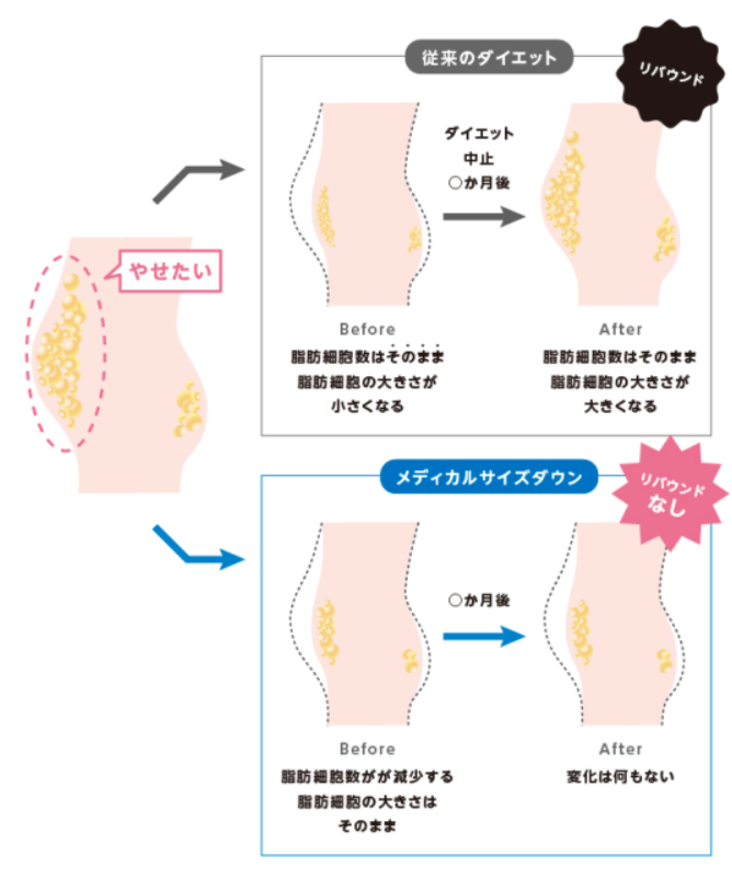 奈良県橿原市の脂肪冷却痩身の痩せるメカニズム