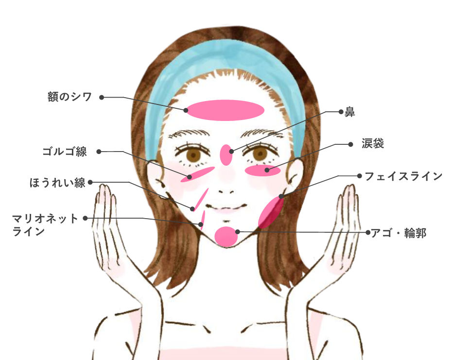 奈良県橿原市のしわ・くぼみ治療『ヒアルロン酸注入』施術部位