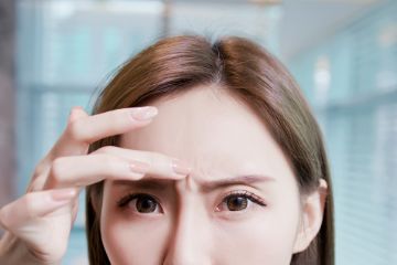 奈良県橿原市の『ボトックス注入』の眉間のシワ治療