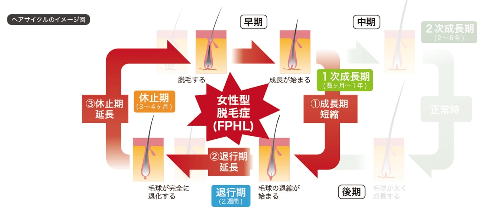 奈良県橿原市の薄毛の原因「毛周期」の治療